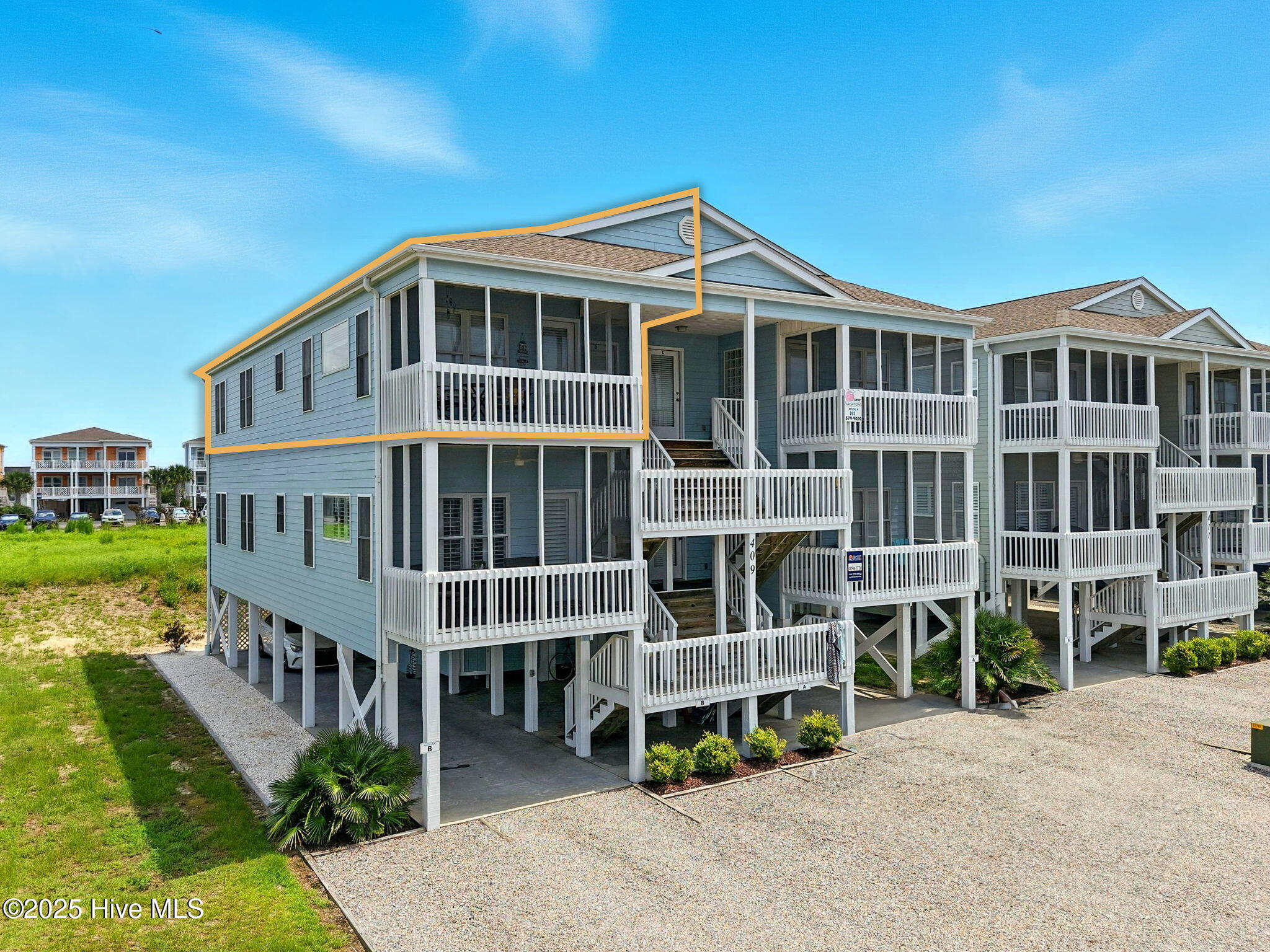 409 27th Street, Unit D Sunset Beach, NC 28468 - Photo 1 of 52 2-web-or-mls-CAMMediaLLC.com b-3