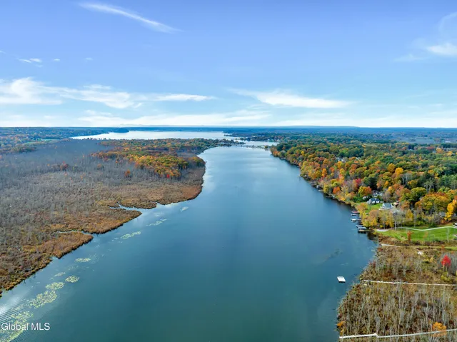 $3,986,000 | 4 Autumn Lane, Saratoga Springs, NY 12866