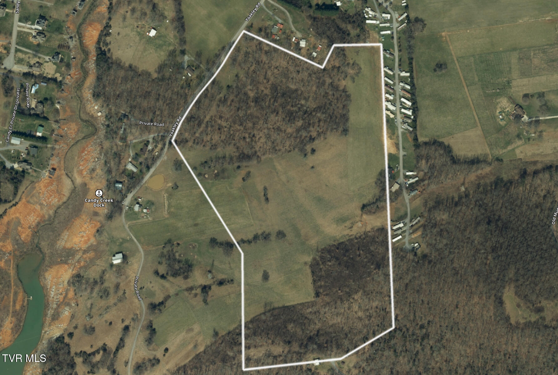 Tbd Yoakley Road, Unit 1 Blountville, TN 37617 - Photo 4 of 36 TBD2 Yoakley Rd-4