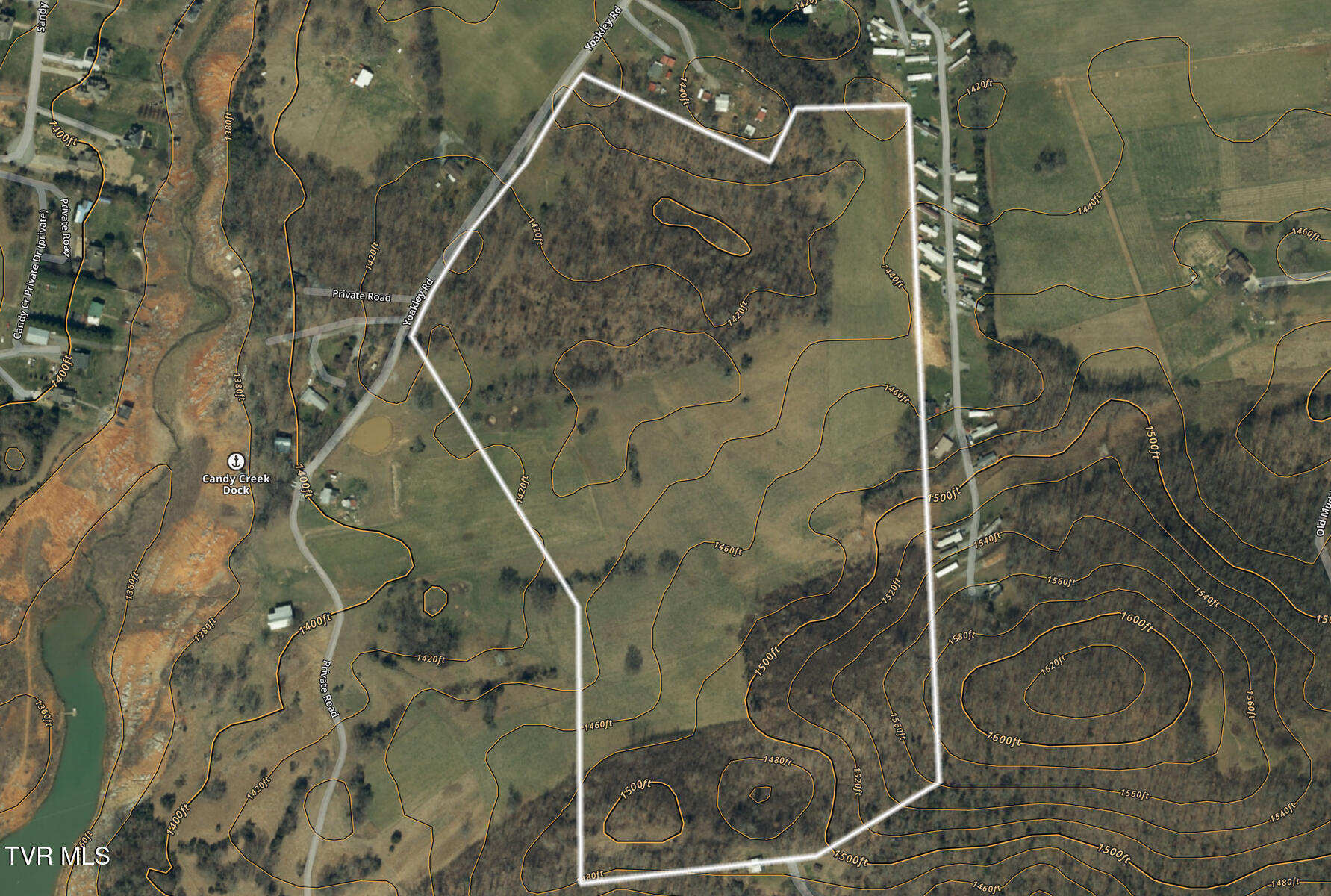 Tbd Yoakley Road, Unit 1 Blountville, TN 37617 - Photo 5 of 36 TBD2 Yoakley Rd-5