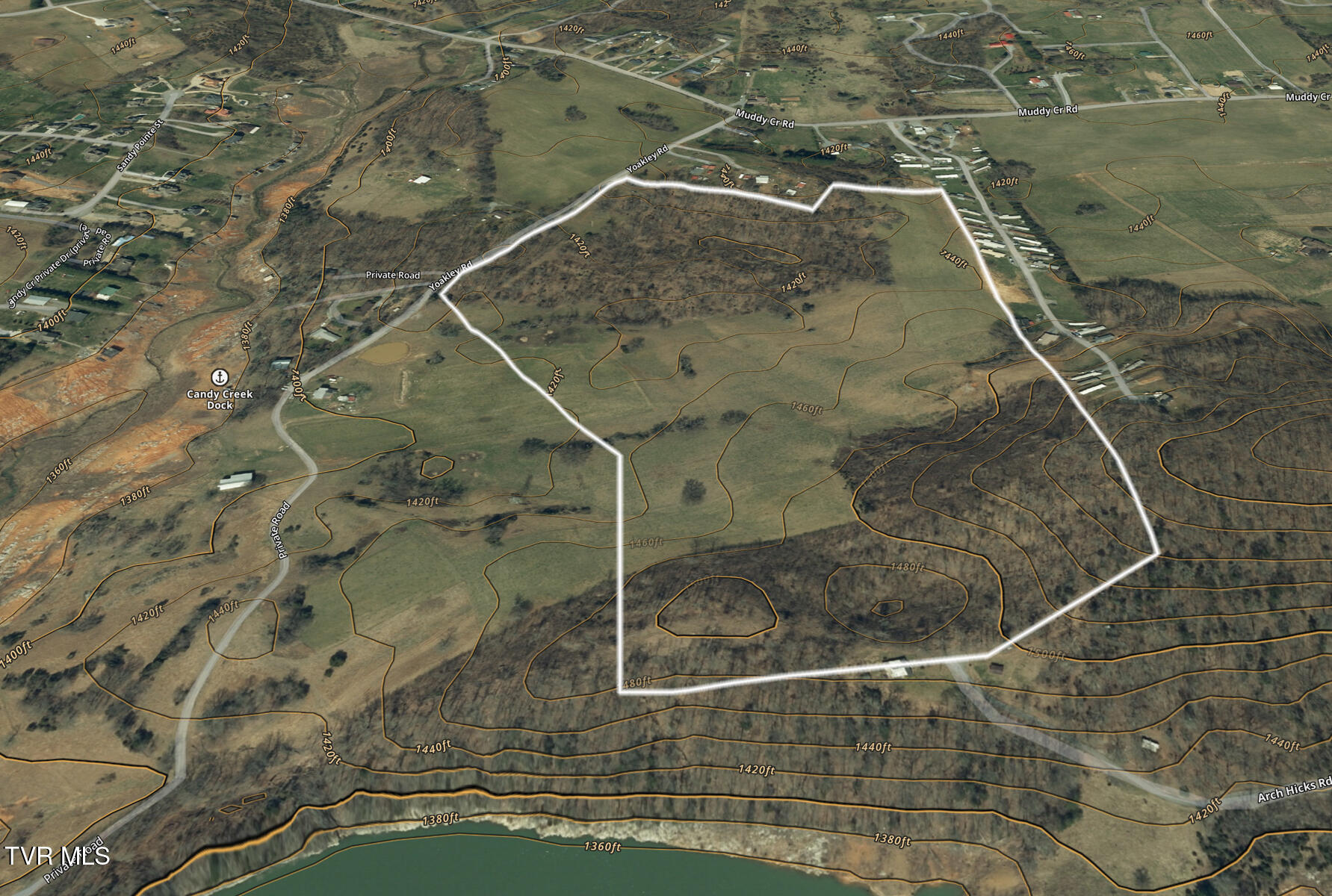 Tbd Yoakley Road, Unit 1 Blountville, TN 37617 - Photo 6 of 36 TBD2 Yoakley Rd-6