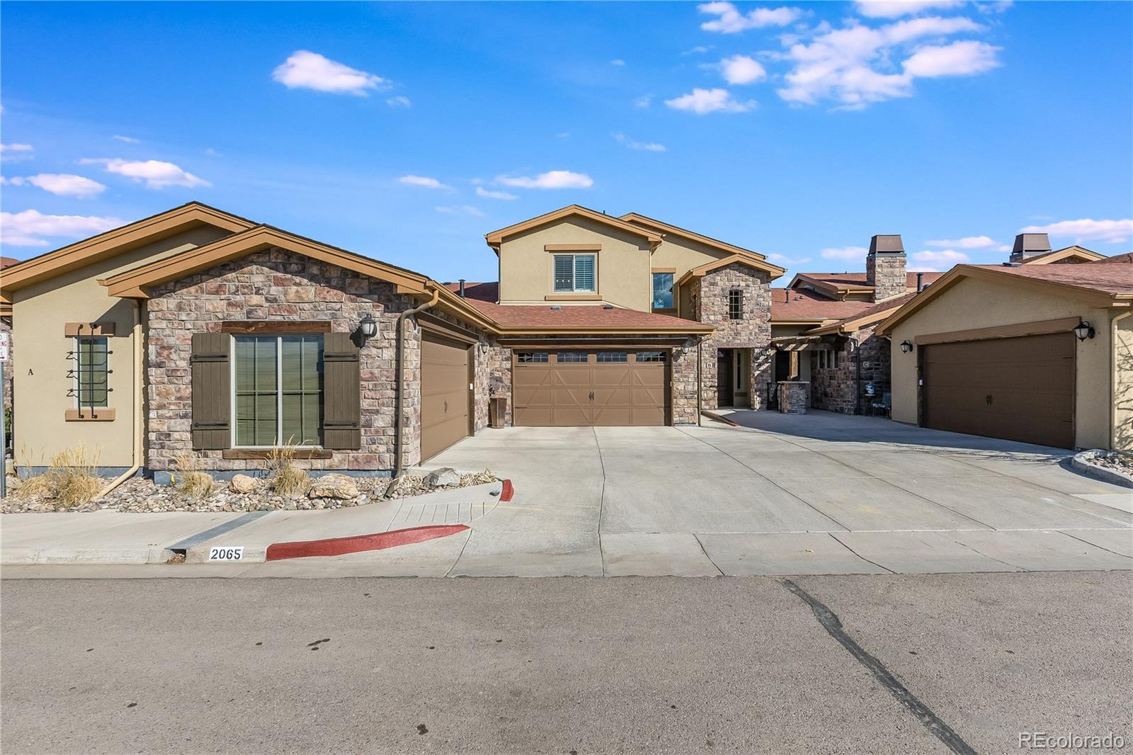 2065 Primo Road, Unit B Highlands Ranch, CO 80129 - Photo 5 of 37 Gallery Image 5