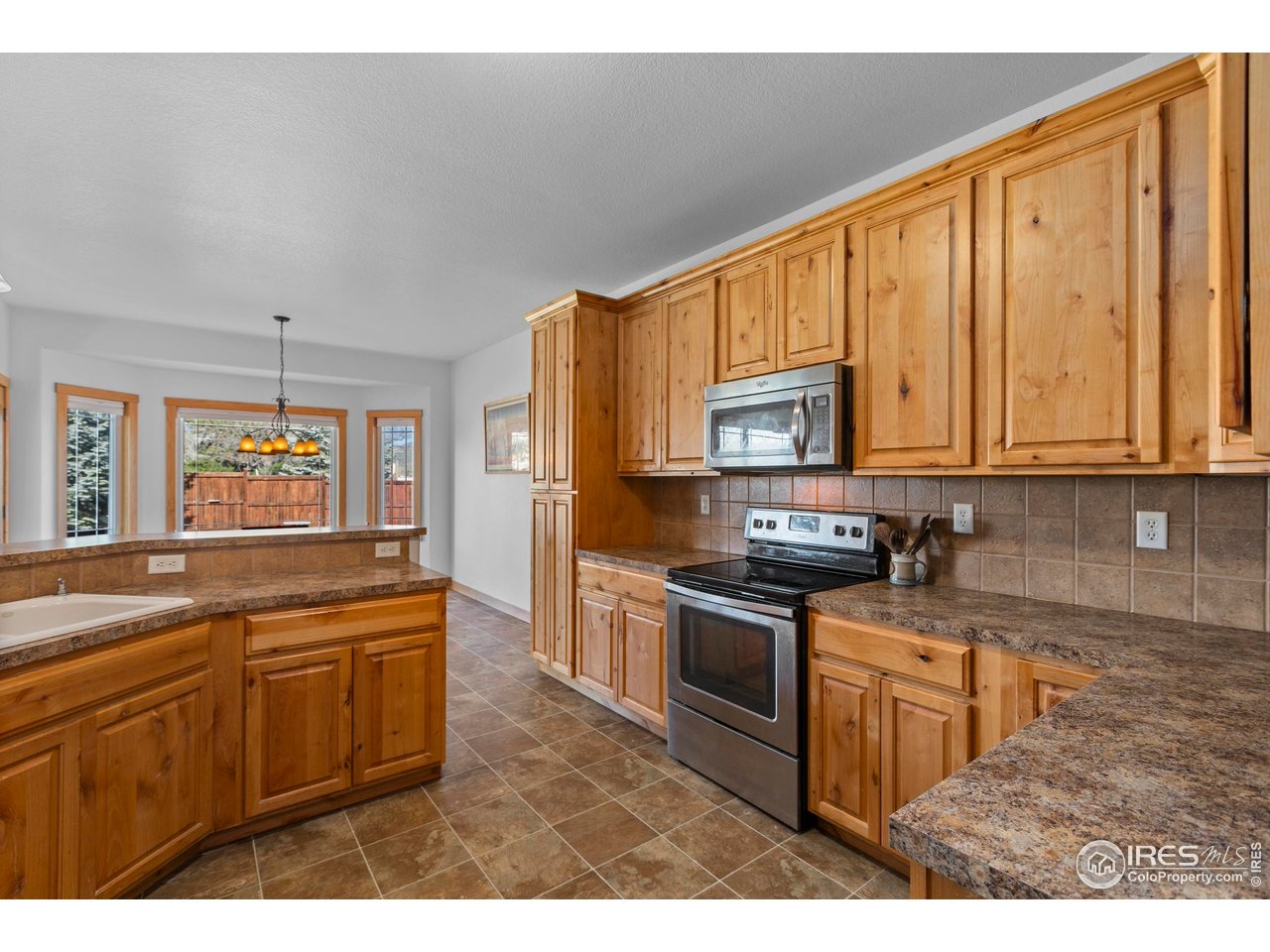 1415 Ripple Court Fort Collins, CO 80521 - Photo 14 of 39 Gallery Image 14