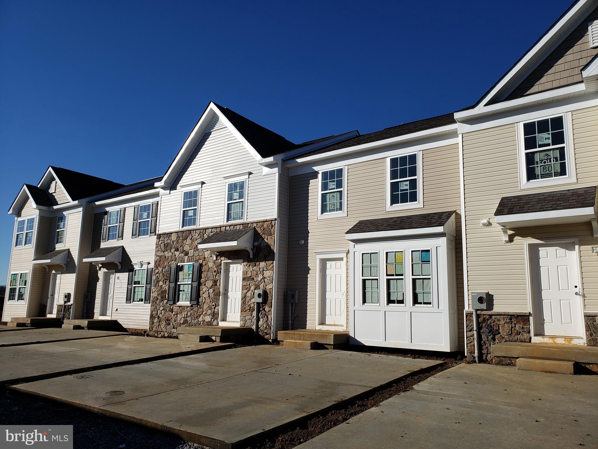 145 Ran Rue Drive Martinsburg, WV 25403 - Photo 3 of 27 Gallery Image 3