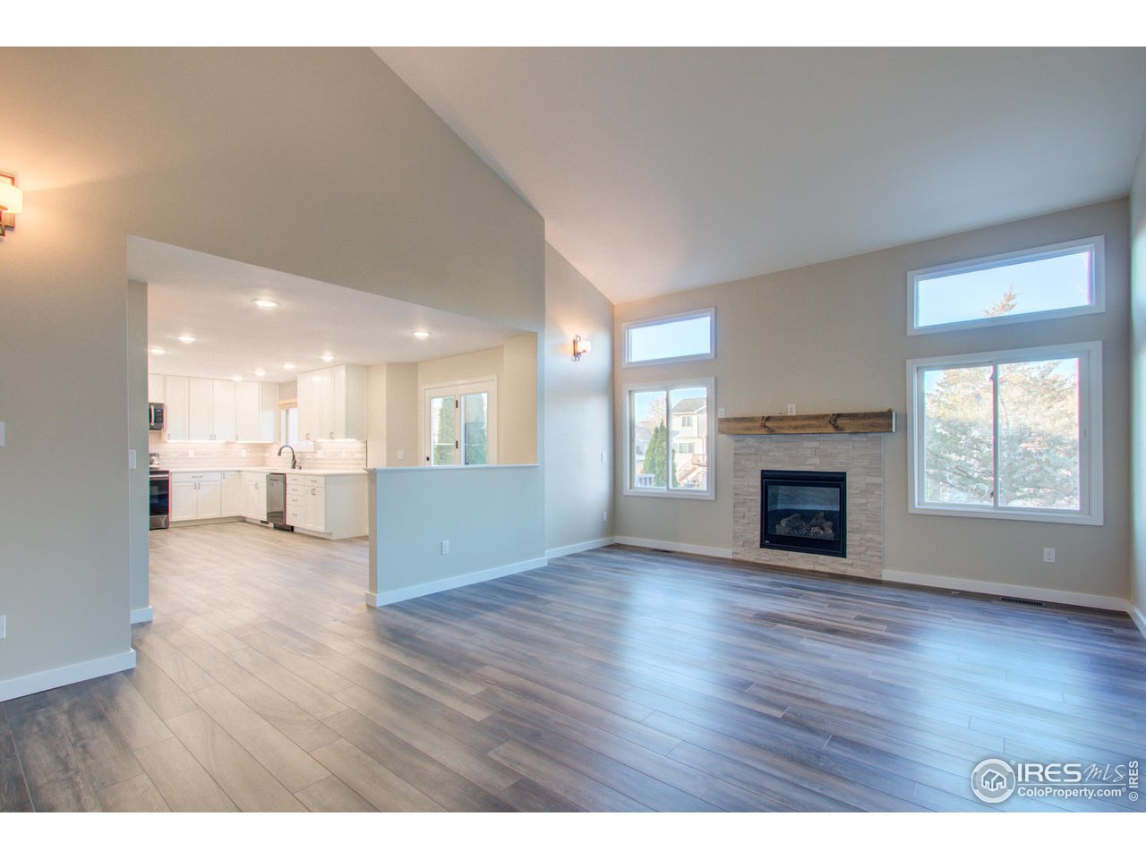 1832 Silvergate Road Fort Collins, CO 80526 - Photo 5 of 31 Gallery Image 5