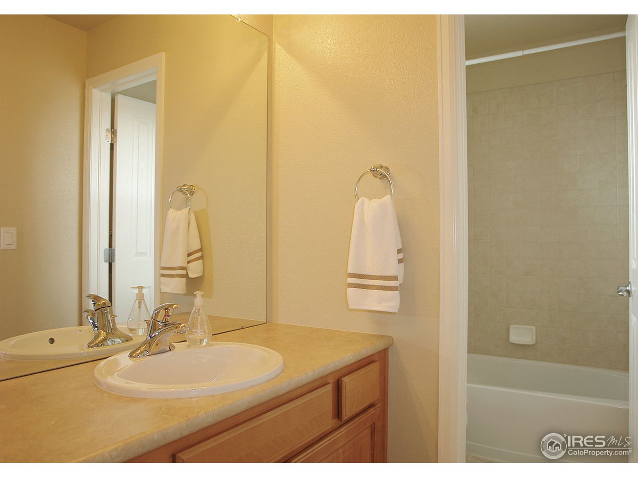 2309 Trestle Road Fort Collins, CO 80525 - Photo 13 of 17 Gallery Image 13