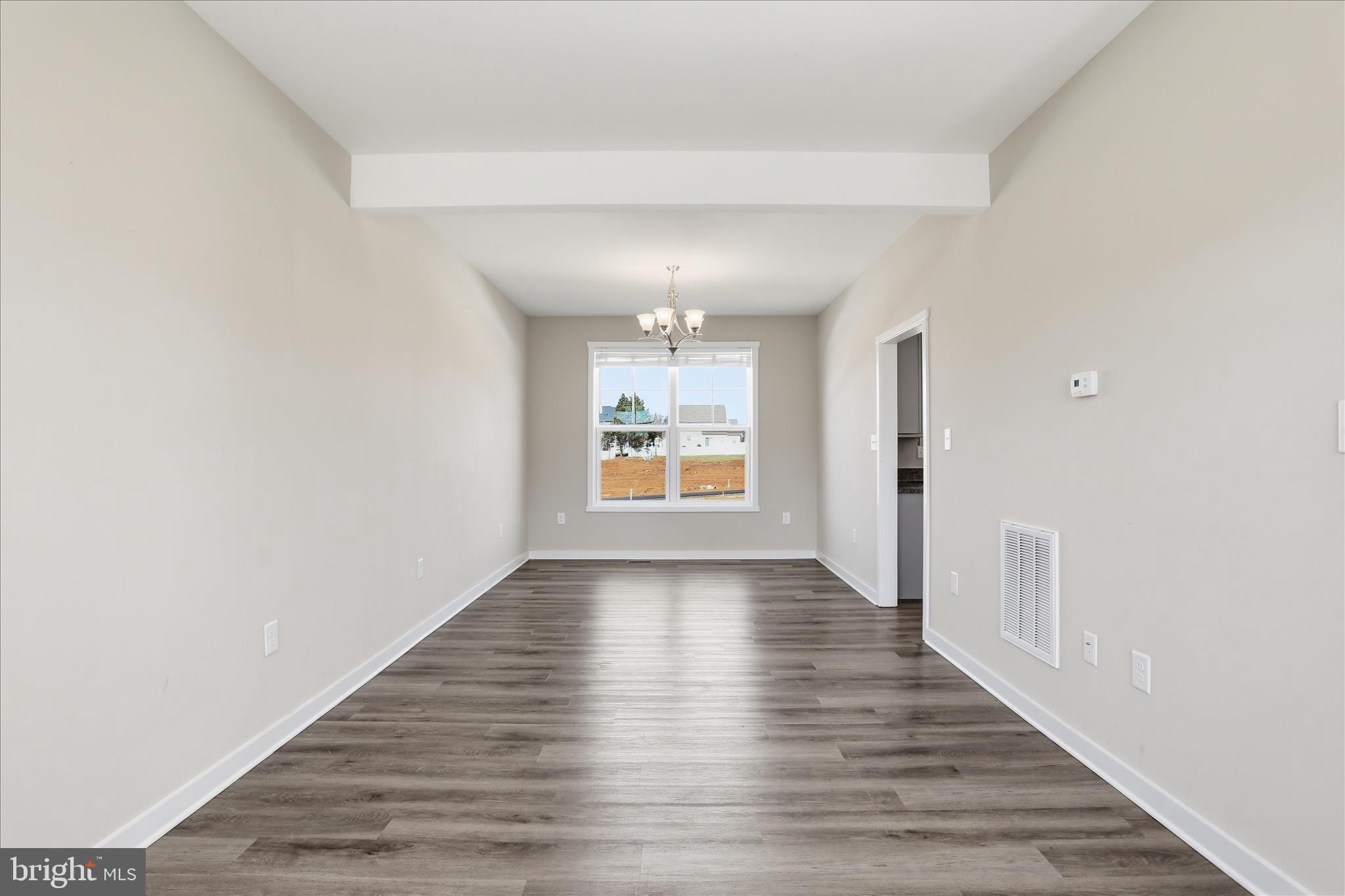 129 Constellation Road Inwood, WV 25428 - Photo 12 of 63 Gallery Image 12