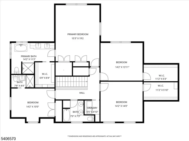 $1,299,900 | 122 Old Stirling Road, Warren, NJ 07059