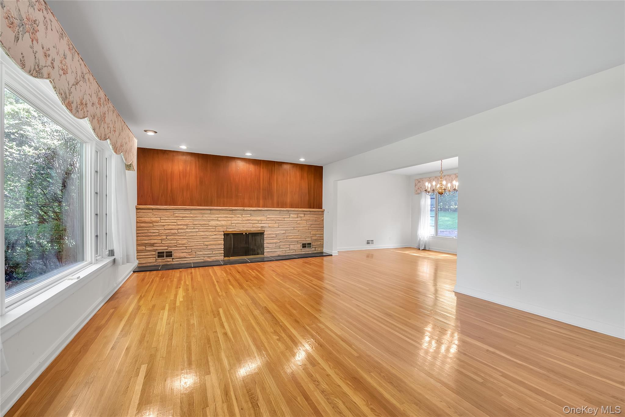 238 Clent Road Great Neck, NY 11021 - Photo 5 of 26 Gallery Image 5