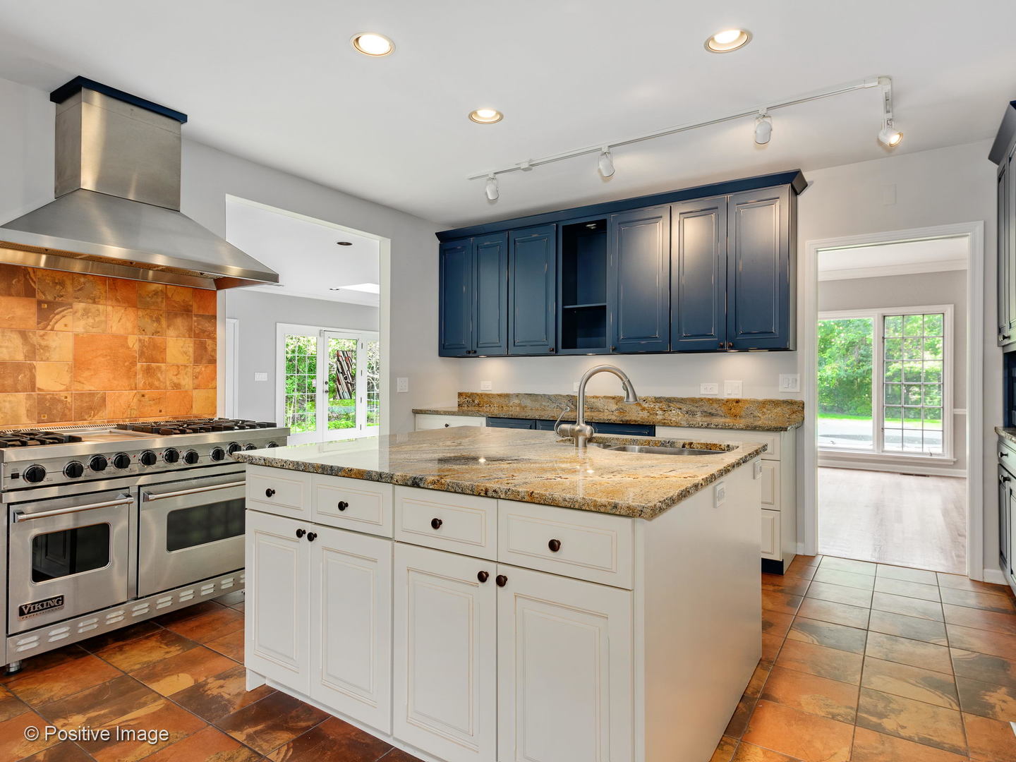 27 Meadowview Road Northfield, IL 60093 - Photo 11 of 44 Gallery Image 11