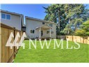 7 A Fern Road, Unit A Everett, WA 98203 - Photo 2 of 14