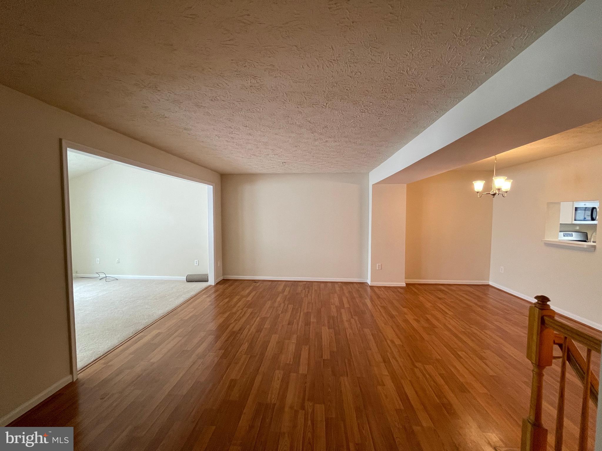 17 Ridge Manor Court Damascus, MD 20872 - Photo 5 of 24 Gallery Image 5