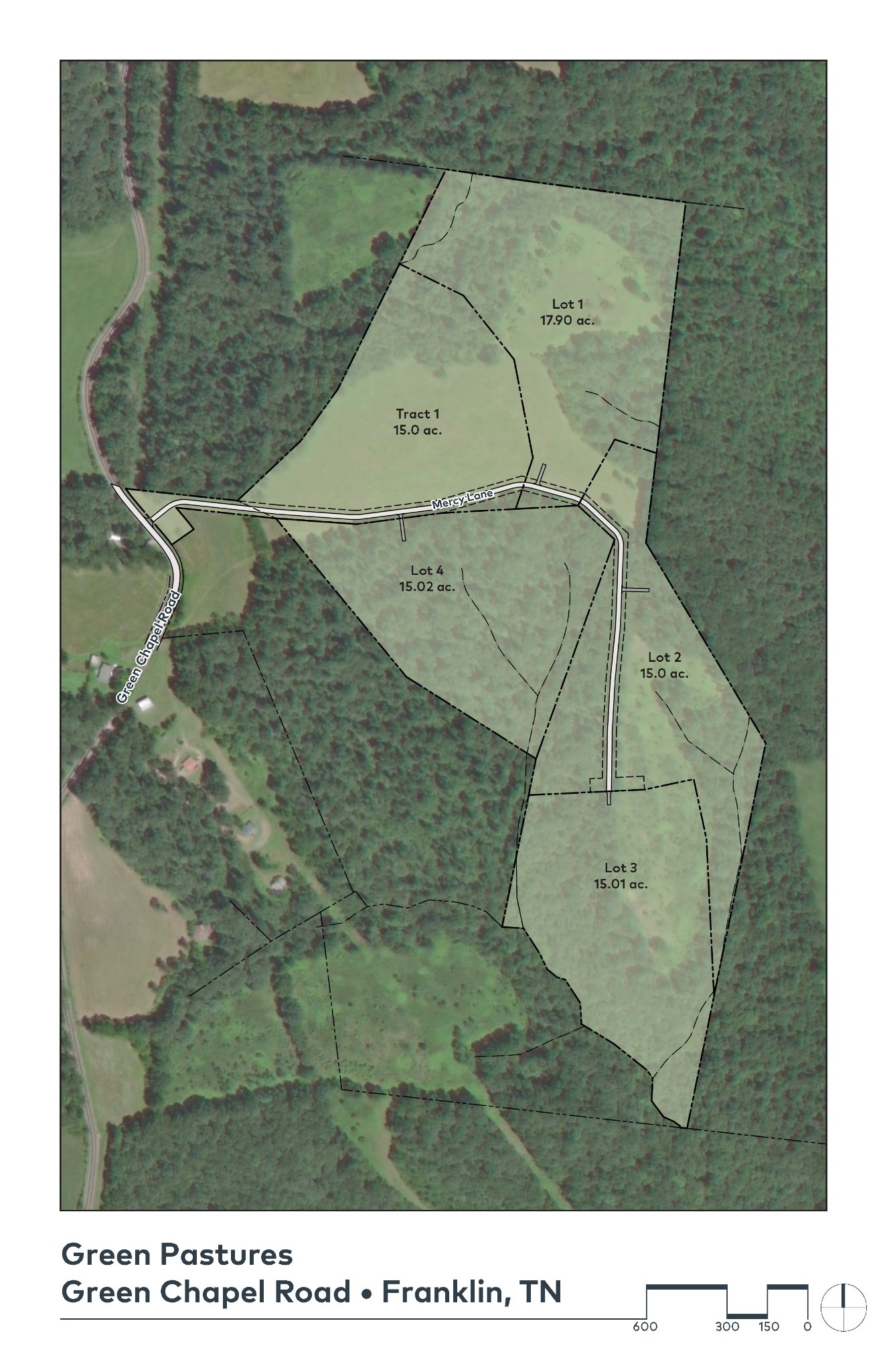 1 Green Chapel Road Franklin, TN 37064 - Photo 10 of 11 Gallery Image 10