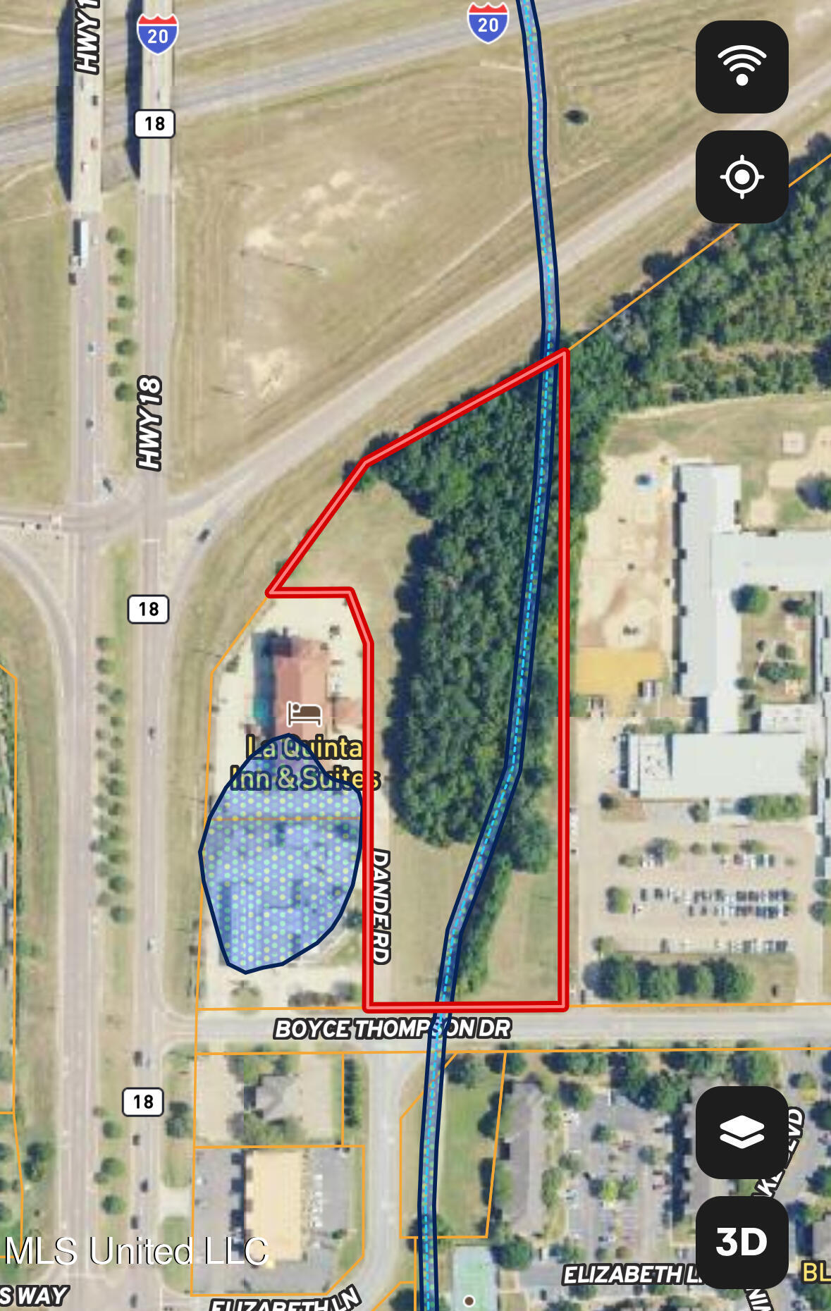 0 Boyce Thompson Drive Brandon, MS 39042 - Photo 13 of 14 Brandon_wetlands