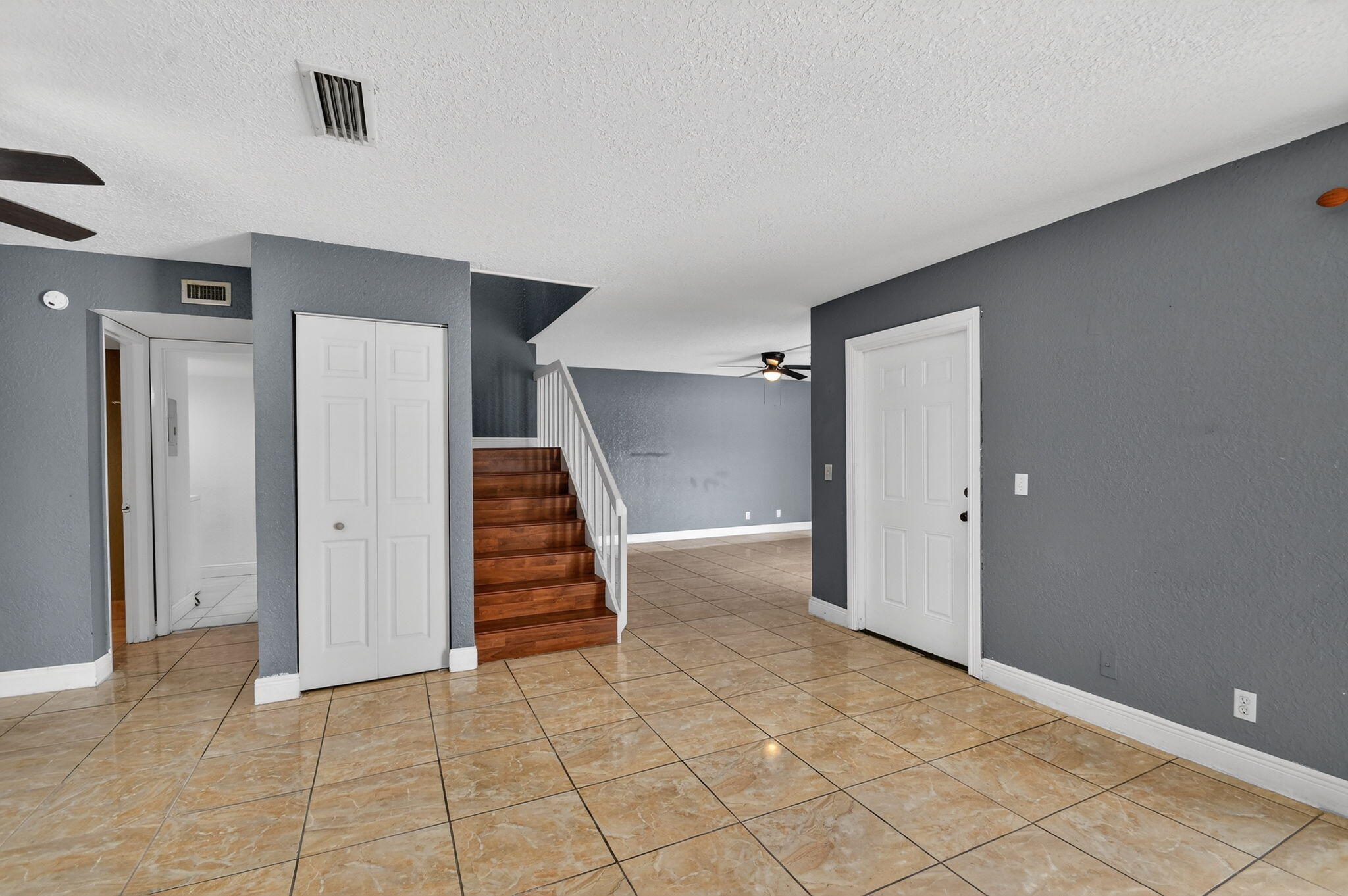 320 Woodland Road Palm Springs, FL 33461 - Photo 9 of 49 10-web-or-mls-DSC_4795