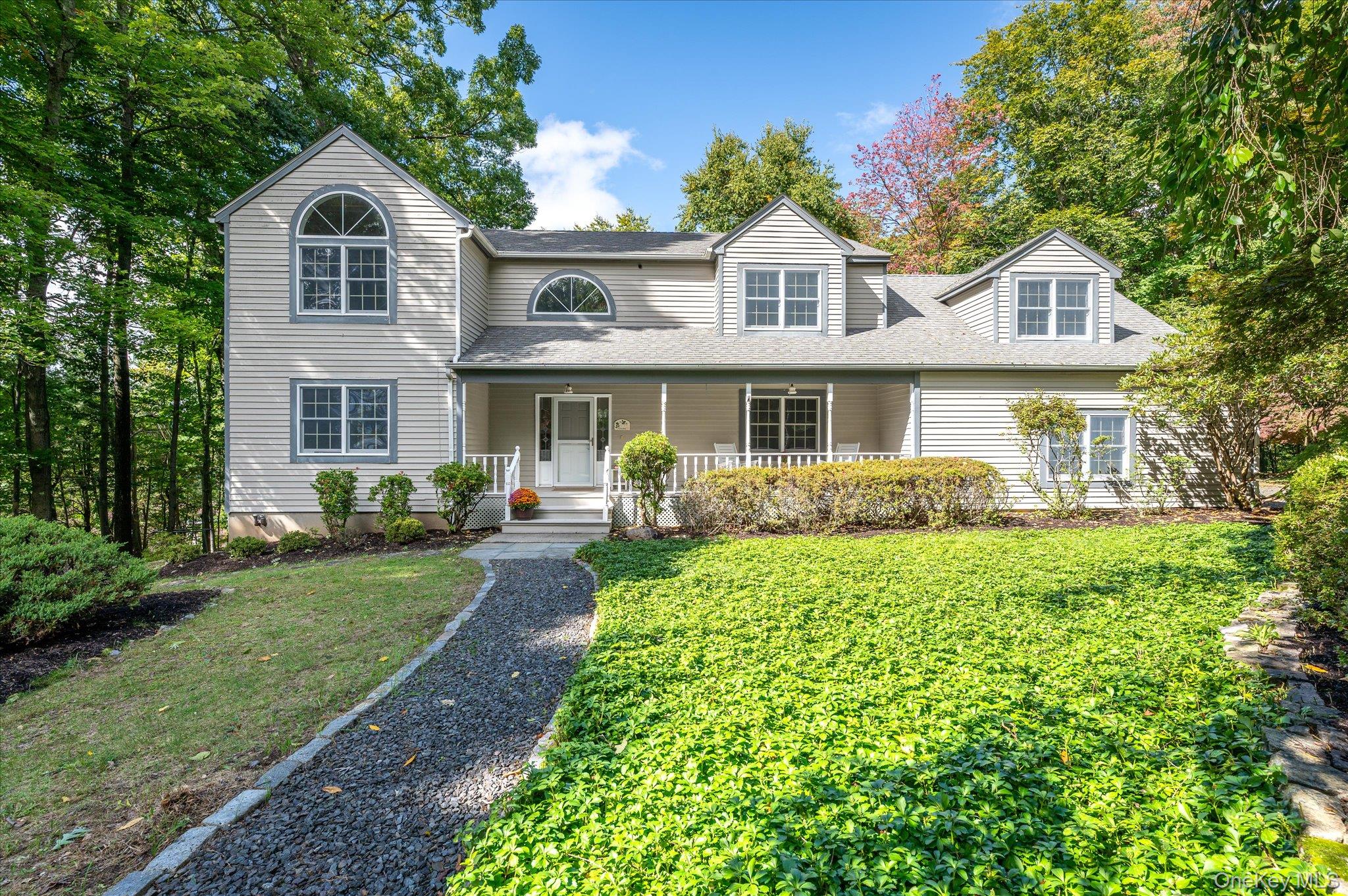 57 Wilner Road Somers, NY 10589 - Photo 1 of 48 Gallery Image 1