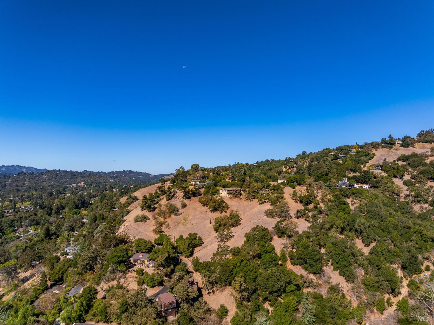 3384 Deer Hill Road Lafayette, CA 94549 - Photo 69 of 79 Gallery Image 69