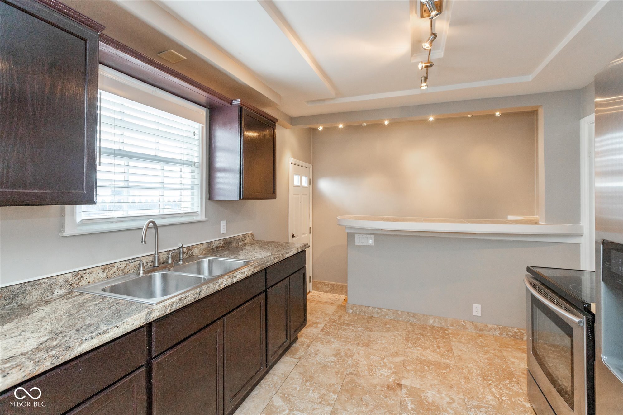 31 North Kenmore Road Indianapolis, IN 46219 - Photo 7 of 23 Gallery Image 7