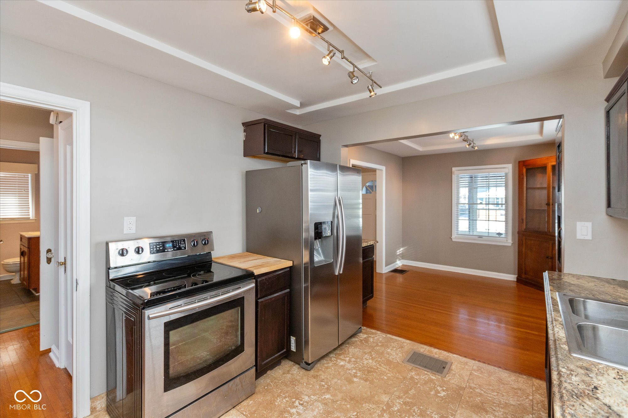 31 North Kenmore Road Indianapolis, IN 46219 - Photo 8 of 23 Gallery Image 8