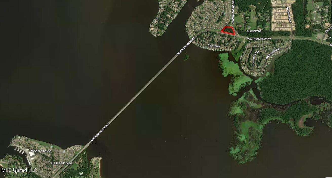 0 North Shore Parkway Brandon, MS 39047 - Photo 11 of 12 2.5 Acre Corner Commercial2