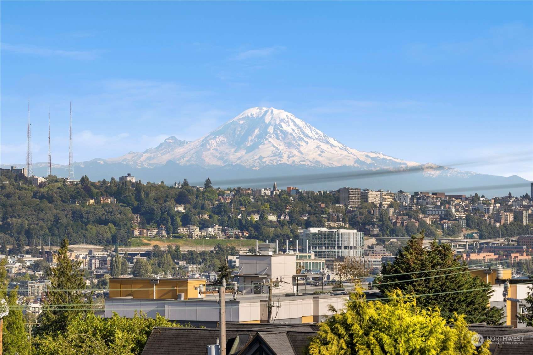 722 North Allen Place Seattle, WA 98103 - Photo 22 of 23 Gallery Image 22