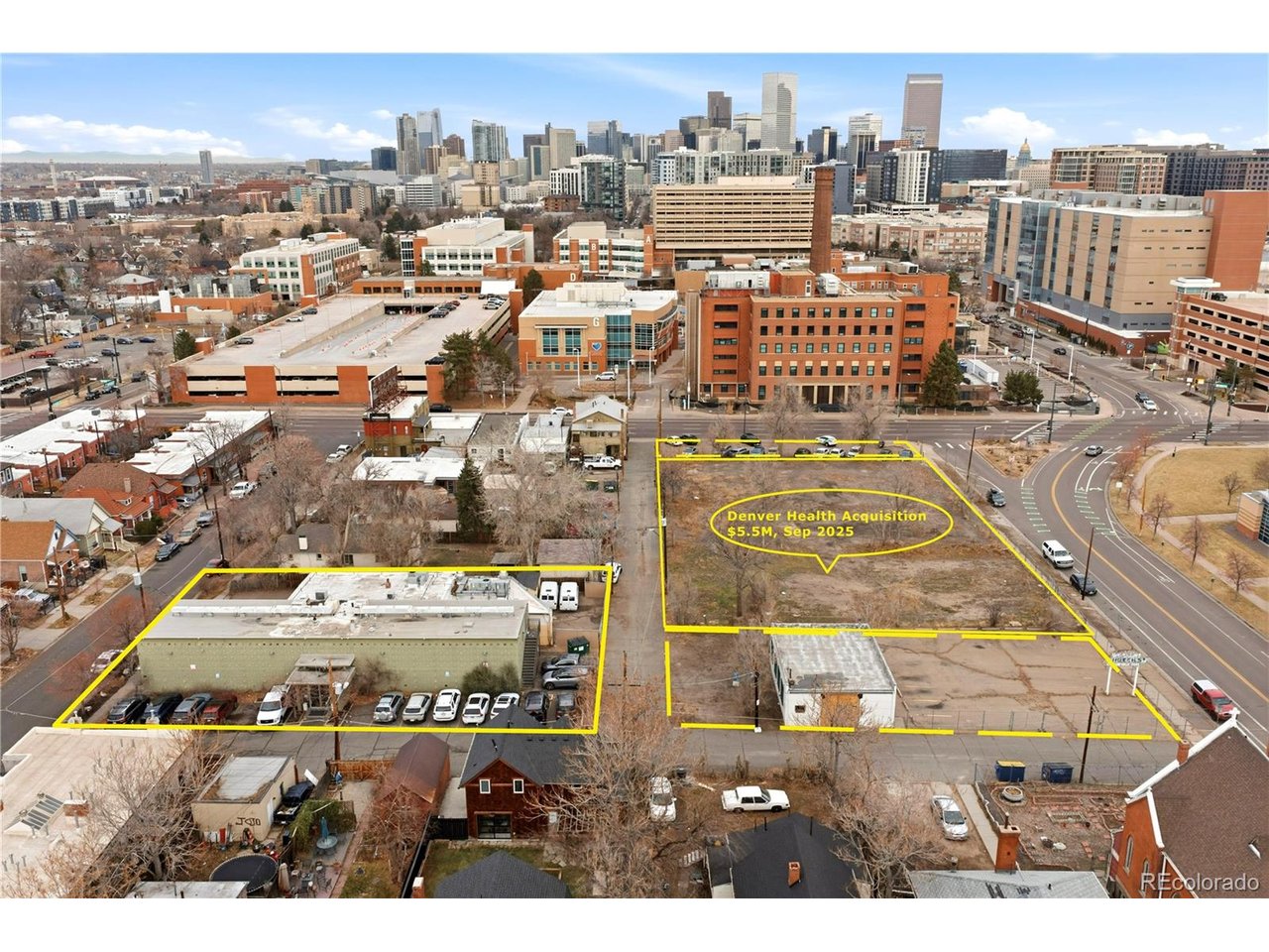 536 Cherokee Street Denver, CO 80204 - Photo 2 of 37 a view of a city