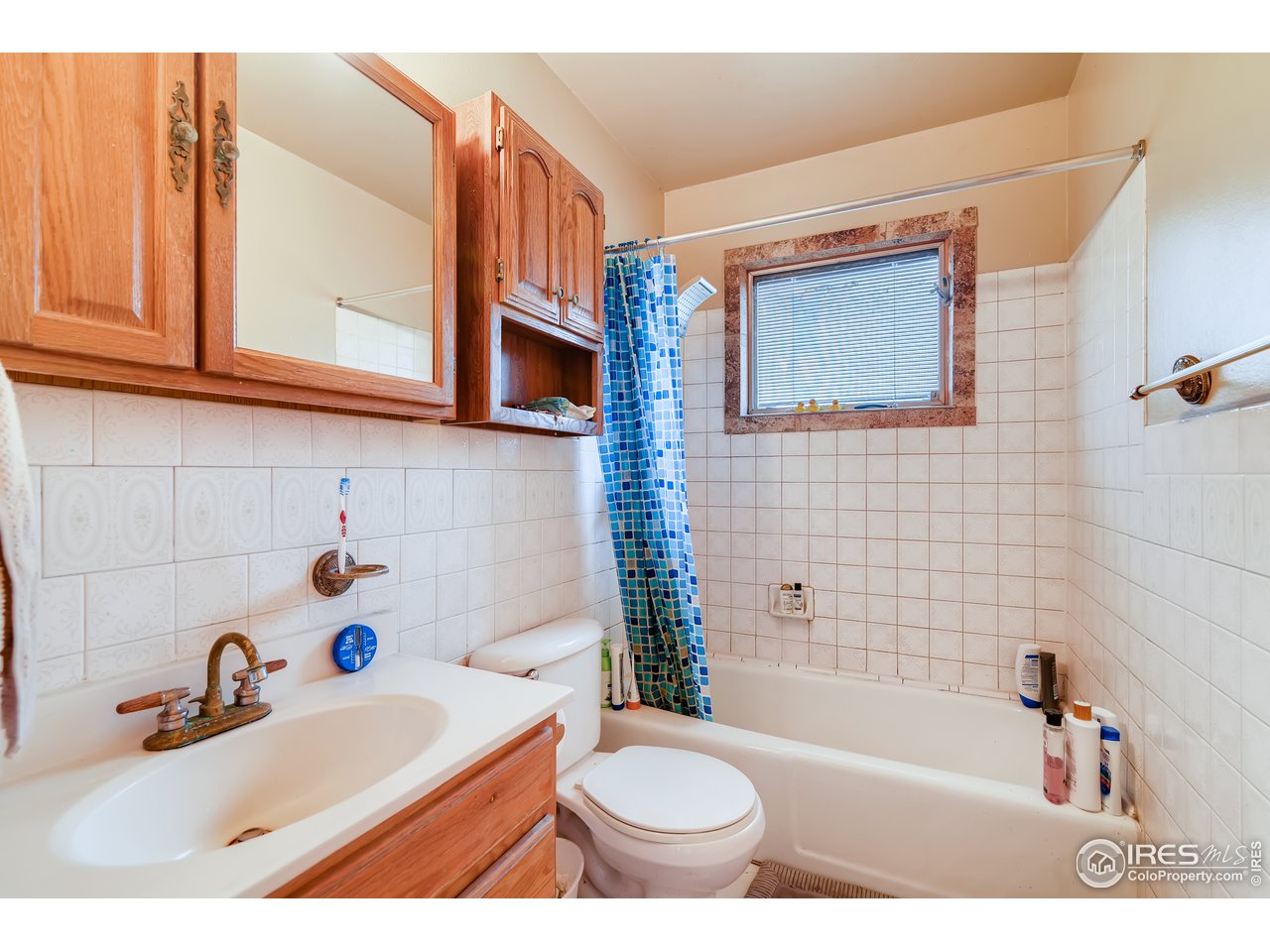 817 Timber Lane Fort Collins, CO 80521 - Photo 15 of 24 Gallery Image 15