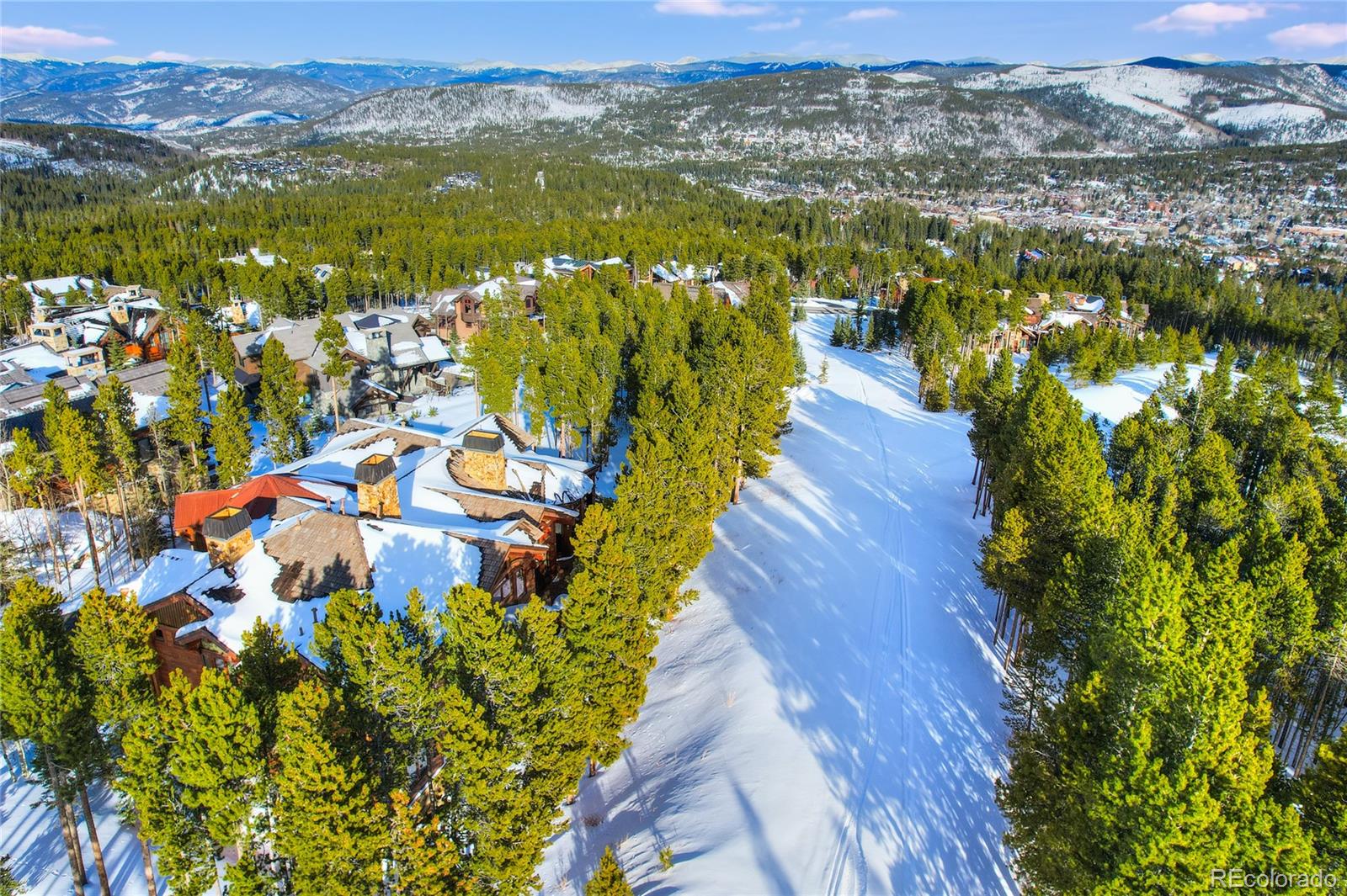 339 Timbertrail Road Breckenridge, CO 80424 - Photo 15 of 18 Gallery Image 15