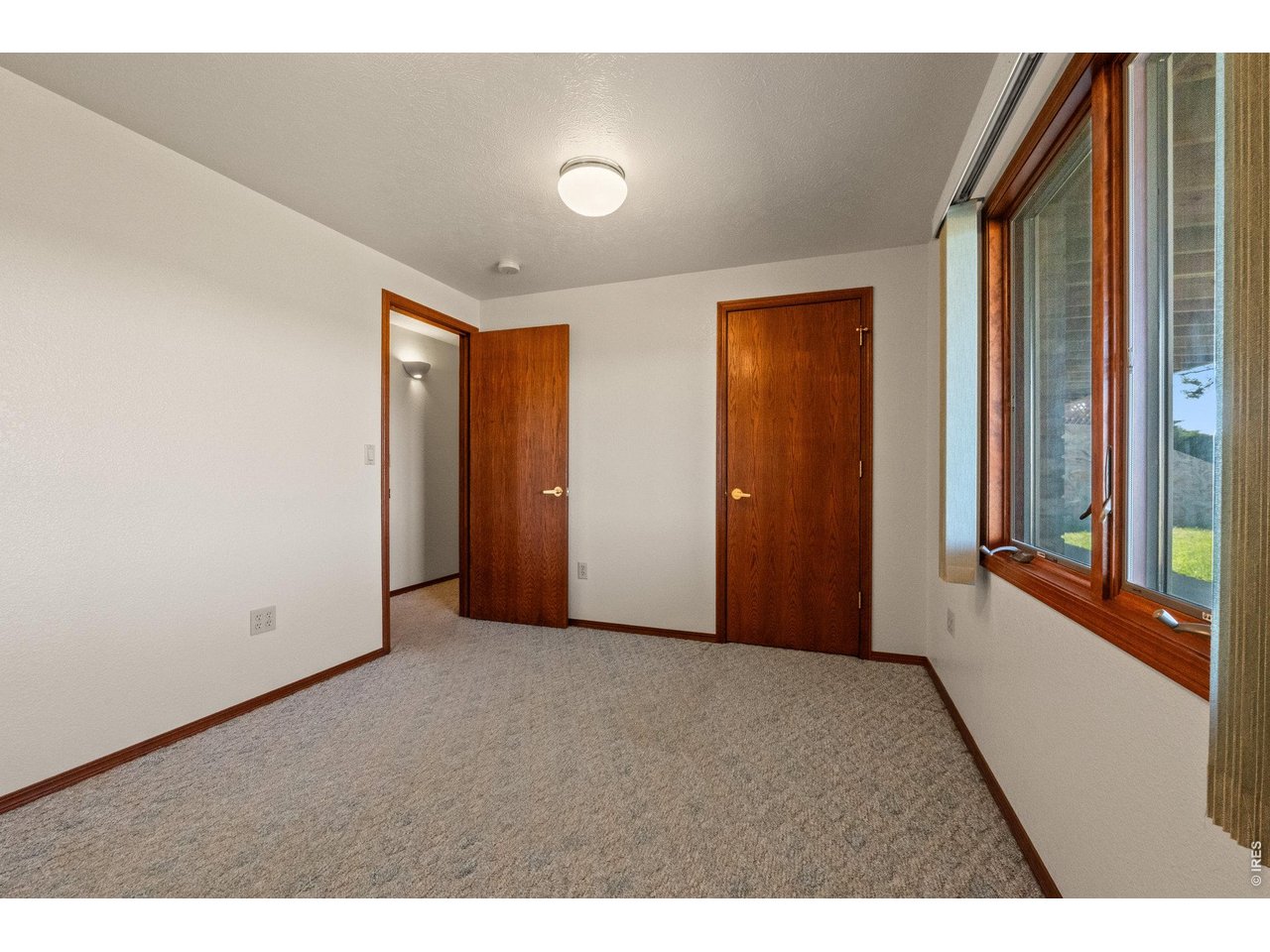 28840 County Road R Brush, CO 80723 - Photo 43 of 50 Gallery Image 43