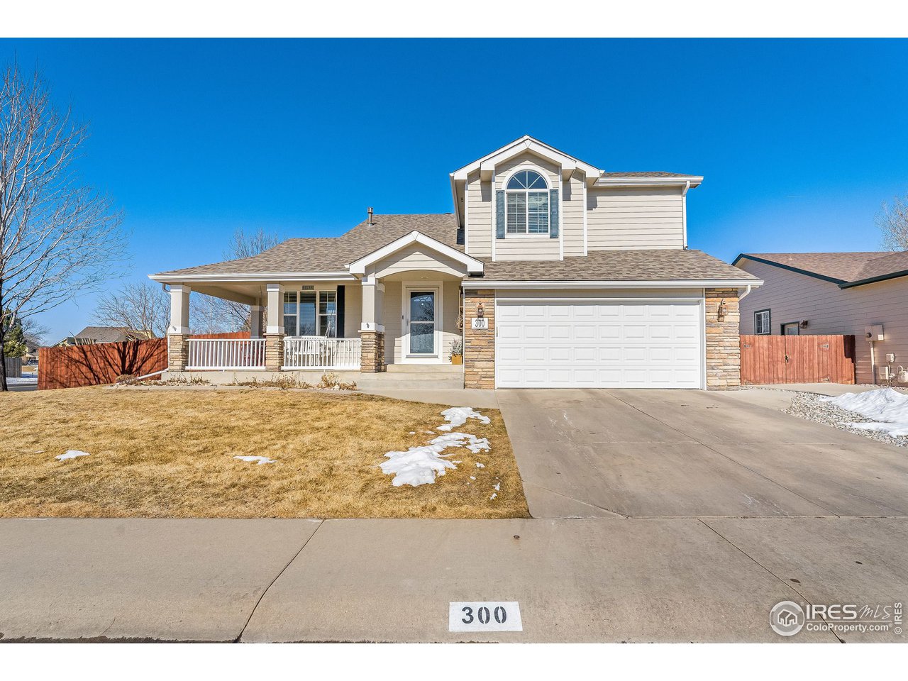 300 Amber Drive Windsor, CO 80550 - Photo 4 of 40