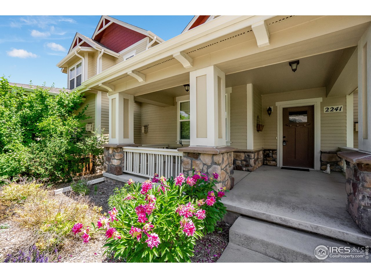 2241 Trestle Road Fort Collins, CO 80525 - Photo 22 of 24 Gallery Image 22