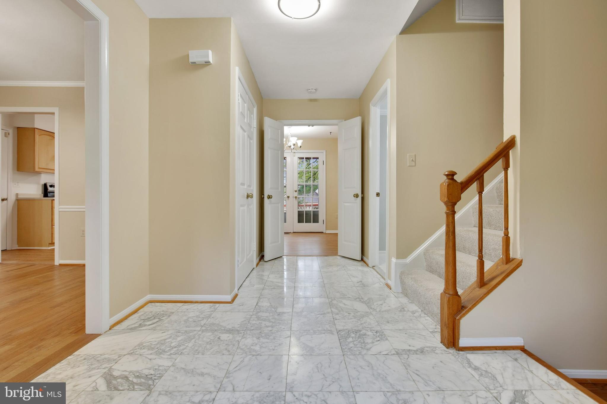 4 Rippling Brook Court Silver Spring, MD 20906 - Photo 11 of 74 Gallery Image 11