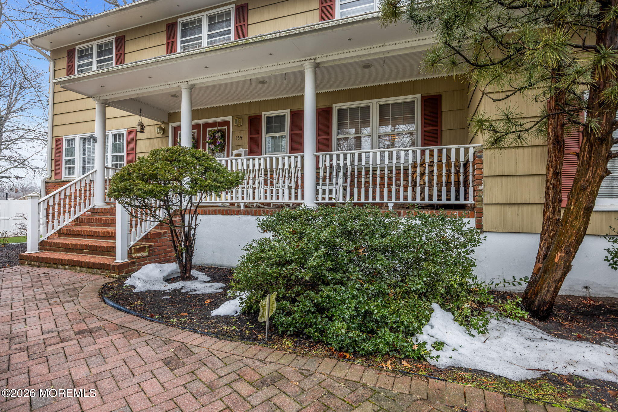 155 Meadow Road Clark, NJ 07066 - Photo 5 of 48 8-web-or-mls-2M1A0395-1