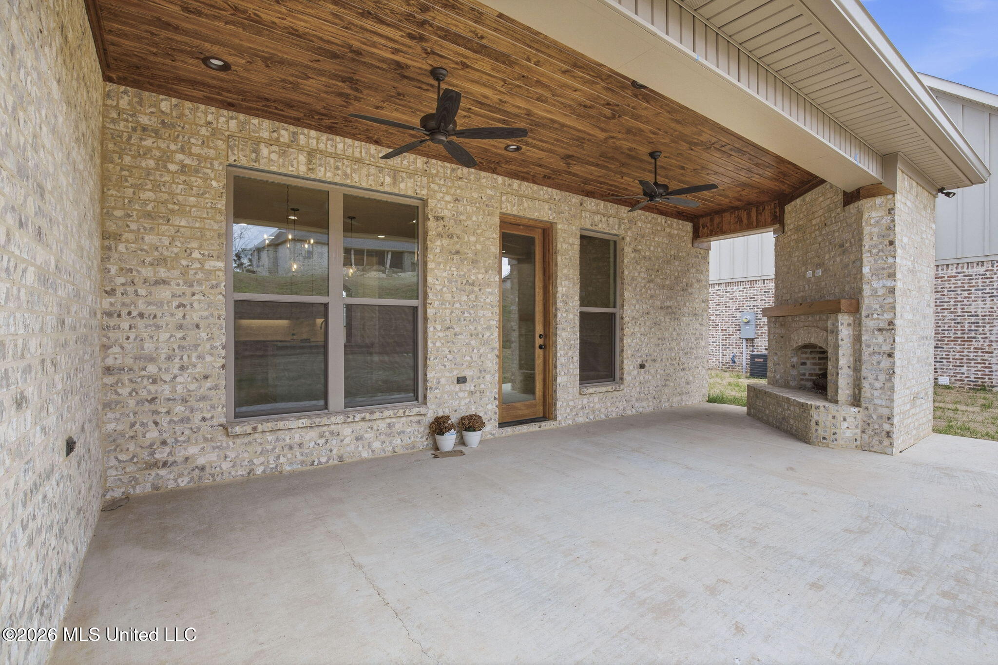 181 Bronson Bend Flowood, MS 39232 - Photo 51 of 60 Covered Patio – Wide Shot