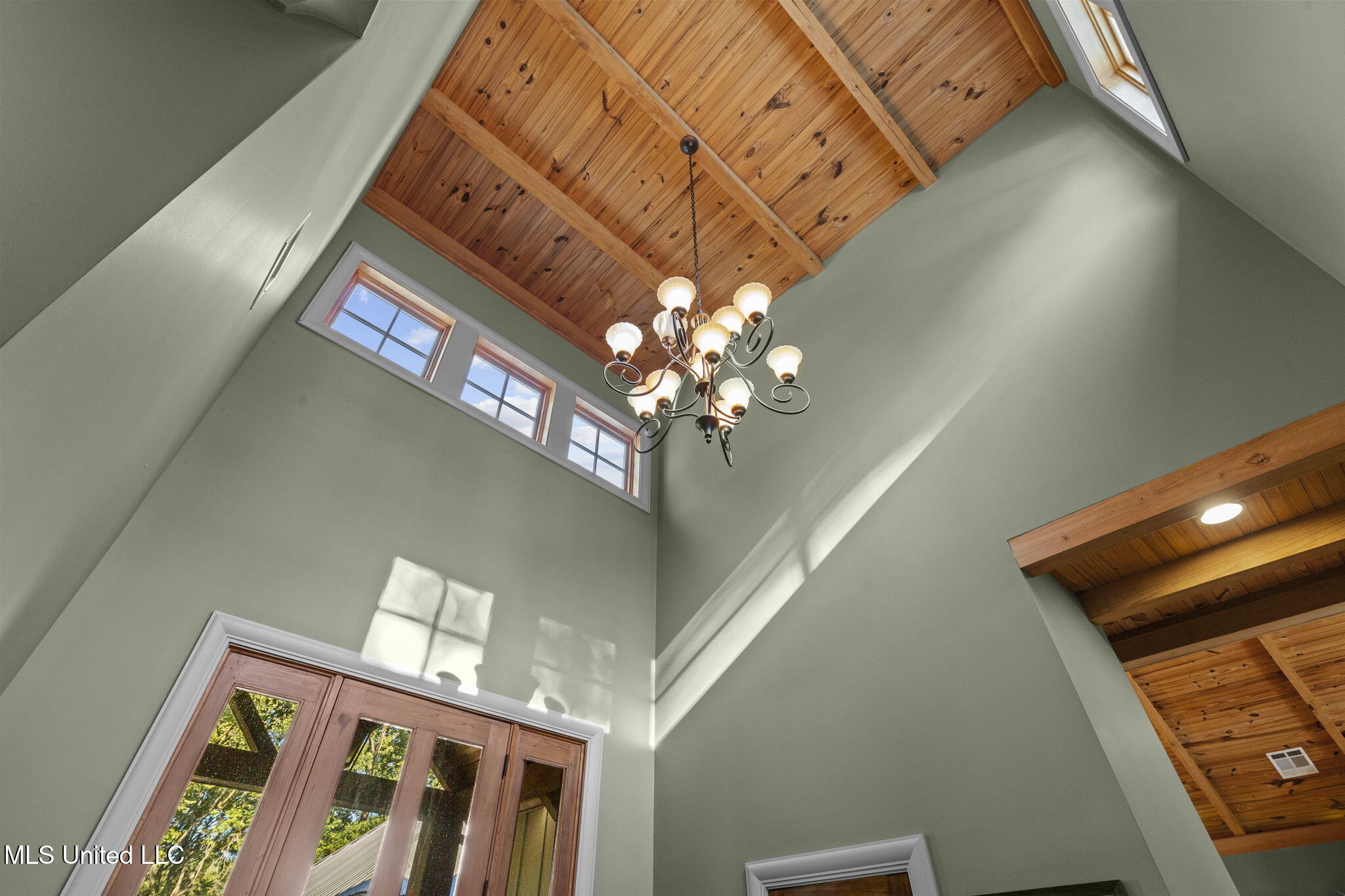 19 Devonshire Way Flora, MS 39071 - Photo 17 of 87 9-web-or-mls-19 Devonshire-9