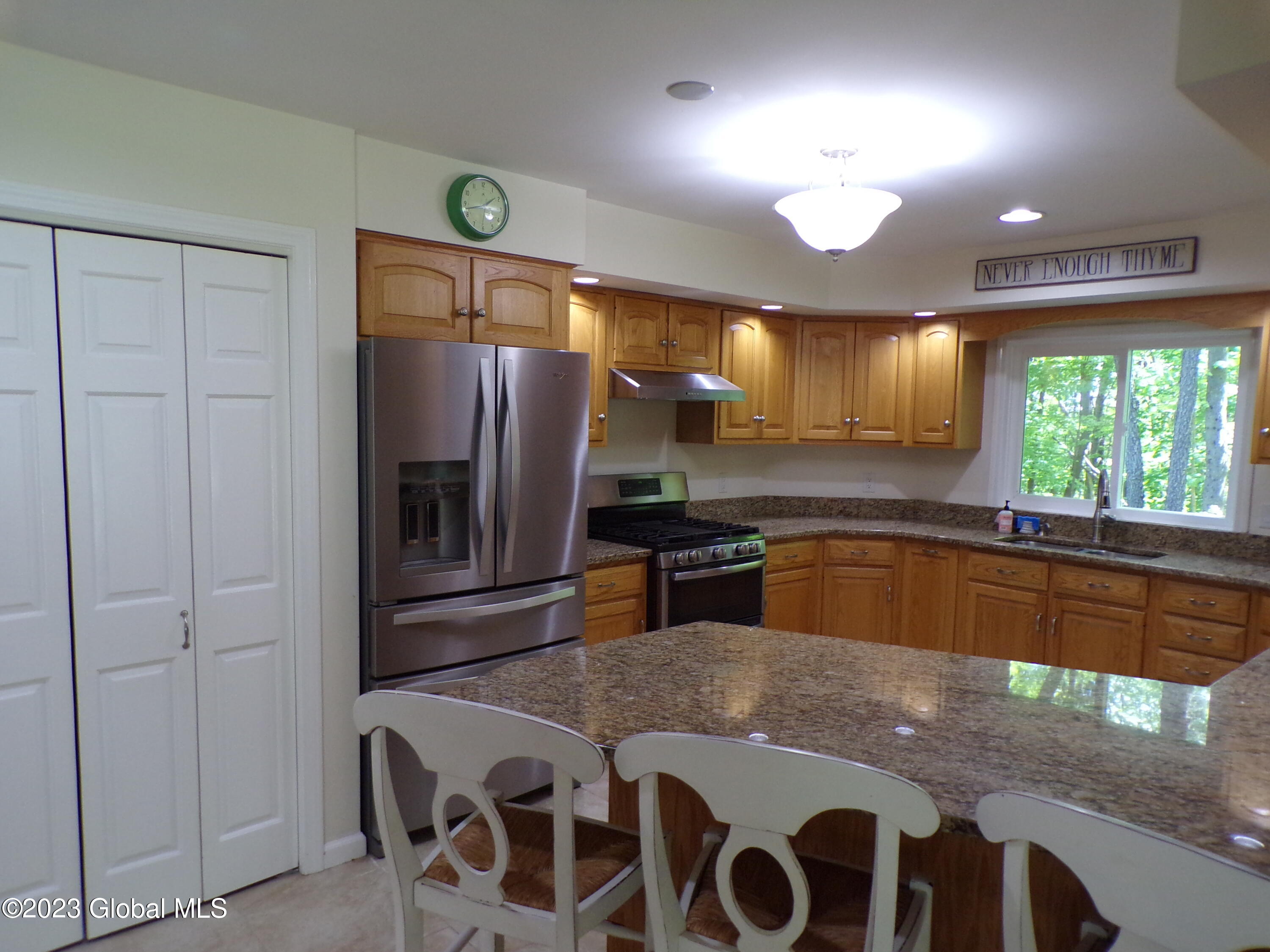819 County Line Road Queensbury, NY 12804 - Photo 13 of 67 Beach Kit 2