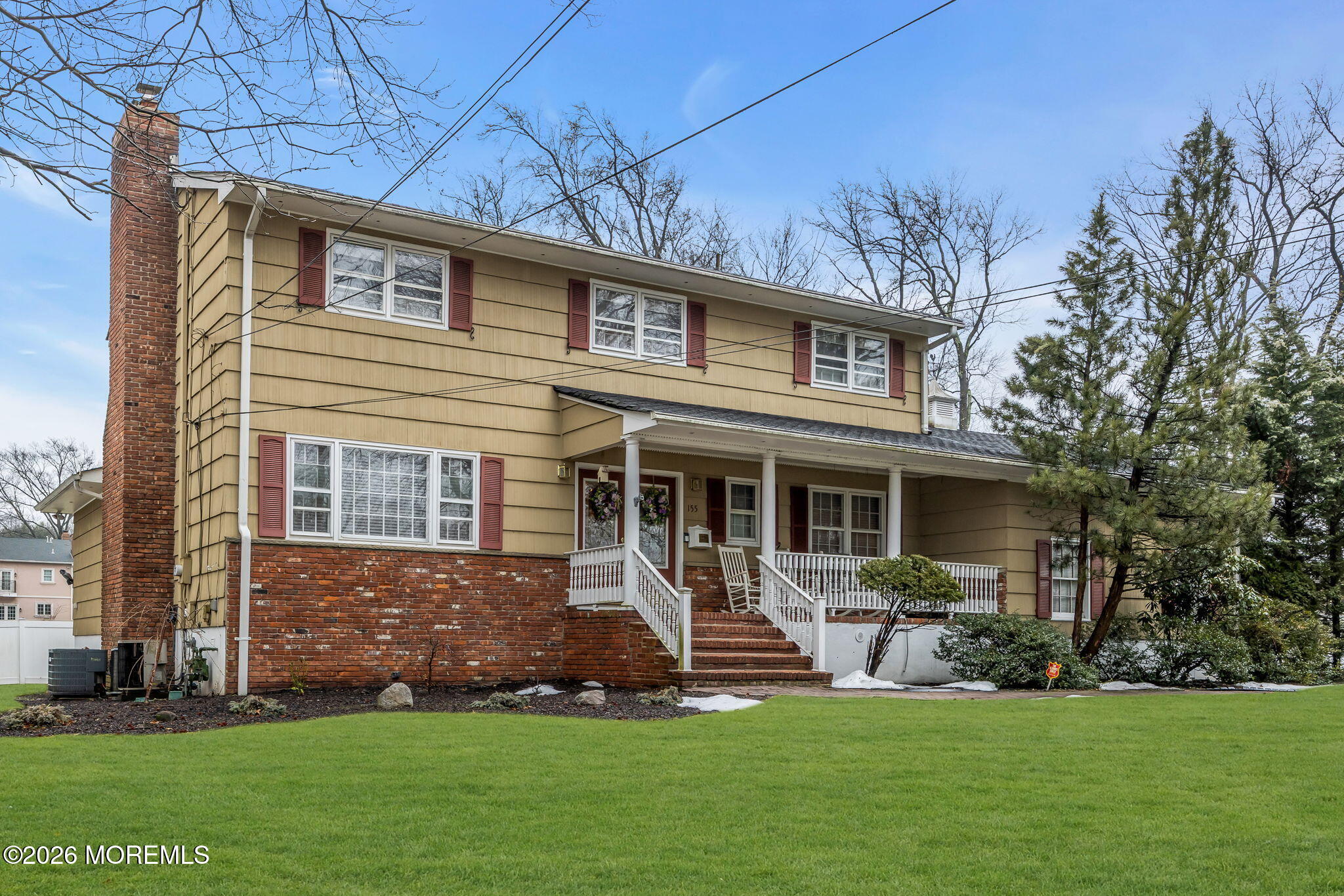 155 Meadow Road Clark, NJ 07066 - Photo 3 of 48 4-web-or-mls-2M1A0385-1b