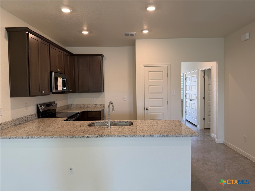 2011 Bear Grass Rdg Road, Unit A Temple, TX 76501 - Photo 5 of 15