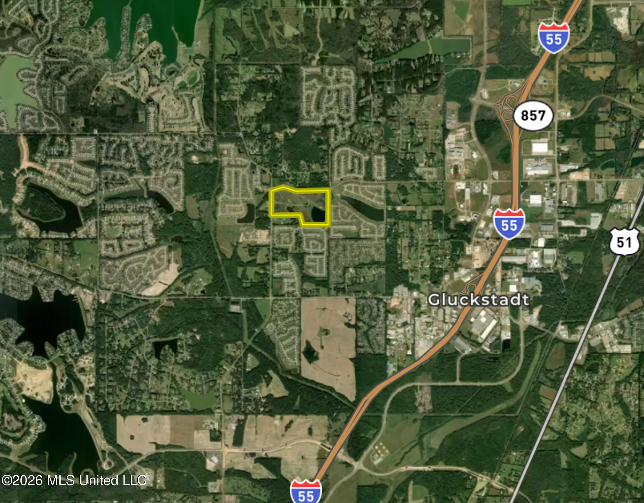 300 Catlett Road Madison, MS 39110 - Photo 4 of 47 Madison 86.2 Gilmer -5