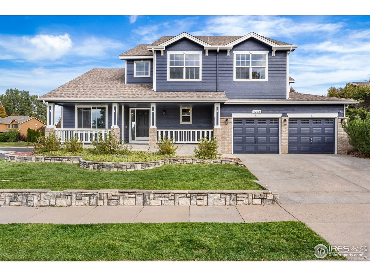 7202 Fort Morgan Drive Fort Collins, CO 80525 - Photo 4 of 46 Gallery Image 4