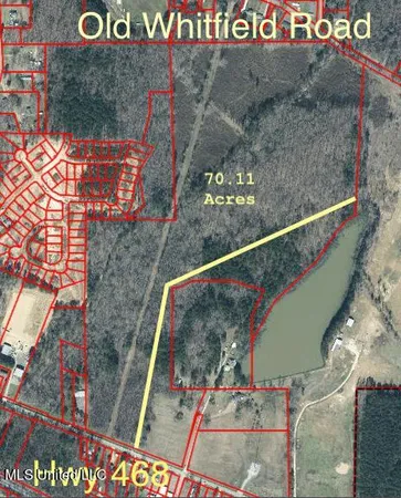 $700,000 | 70.11 Ms-468, Pearl, MS 39208