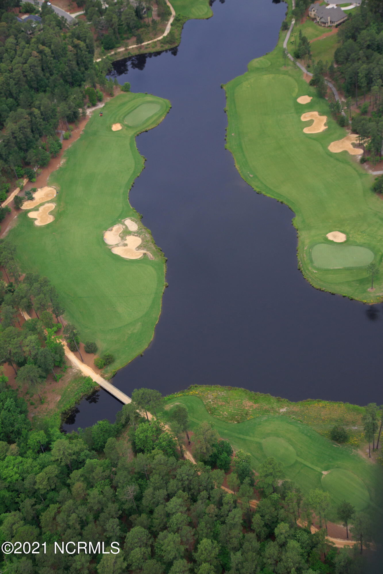 18 Ridgeland Street Pinehurst, NC 28374 - Photo 10 of 12 North Course