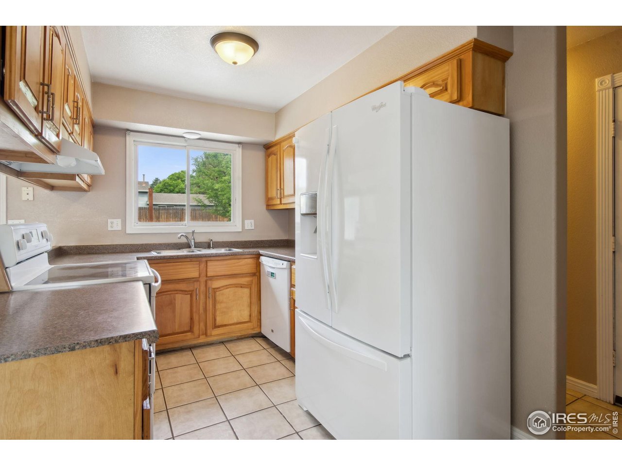 731 Gallup Road Fort Collins, CO 80521 - Photo 6 of 29 Gallery Image 6