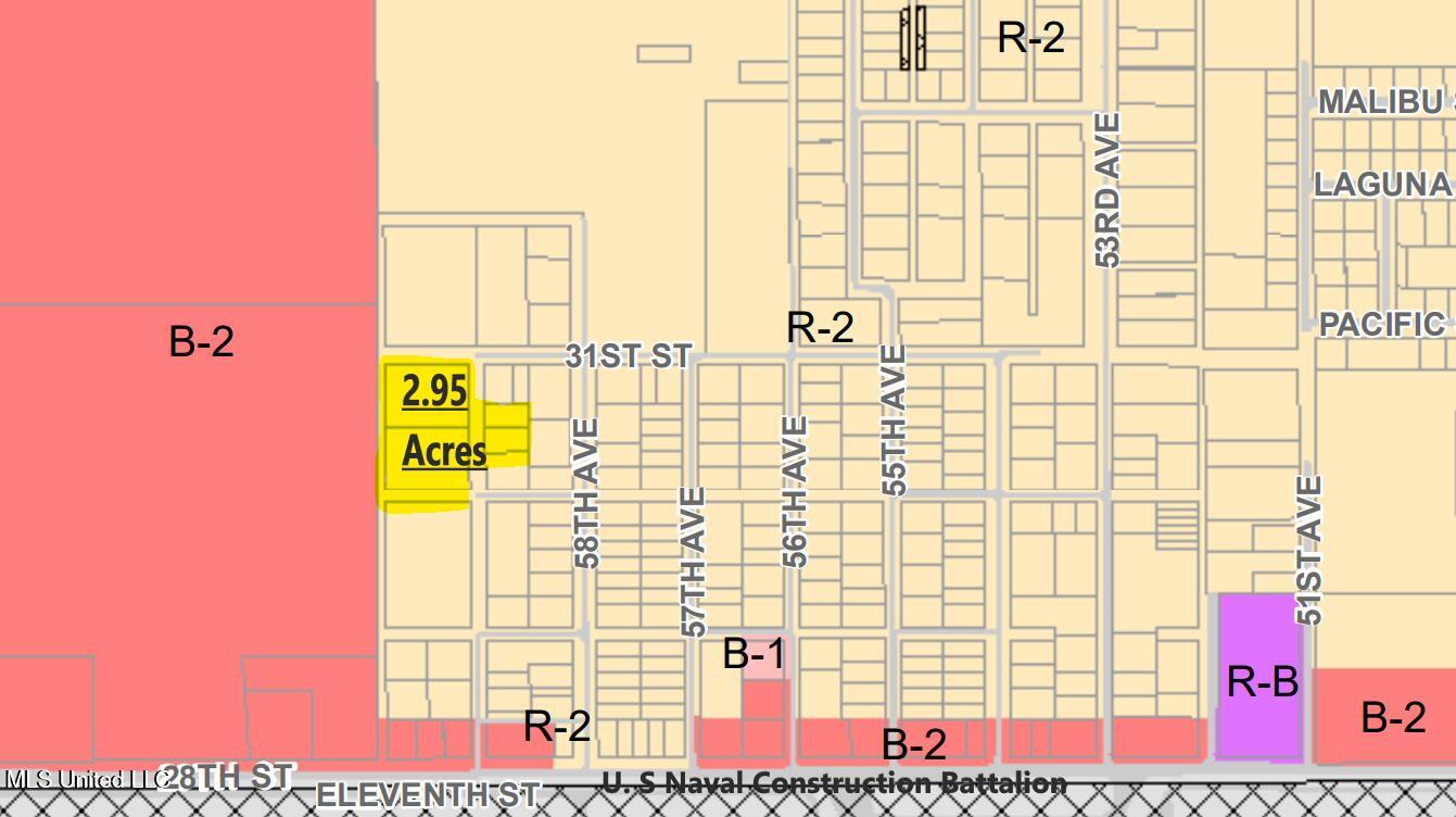 30th Street Gulfport, MS 39501 - Photo 4 of 7 Zoning Map 31st Street Acreage in Gulfpo