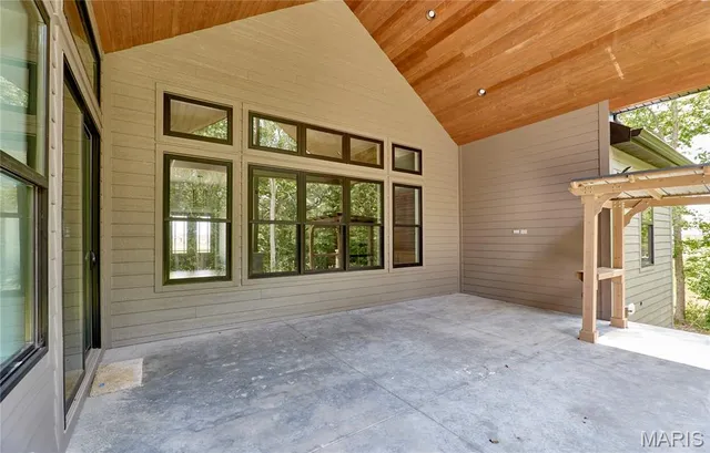 $1,389,000 | 170 Blue Sky Drive, Defiance, MO 63341