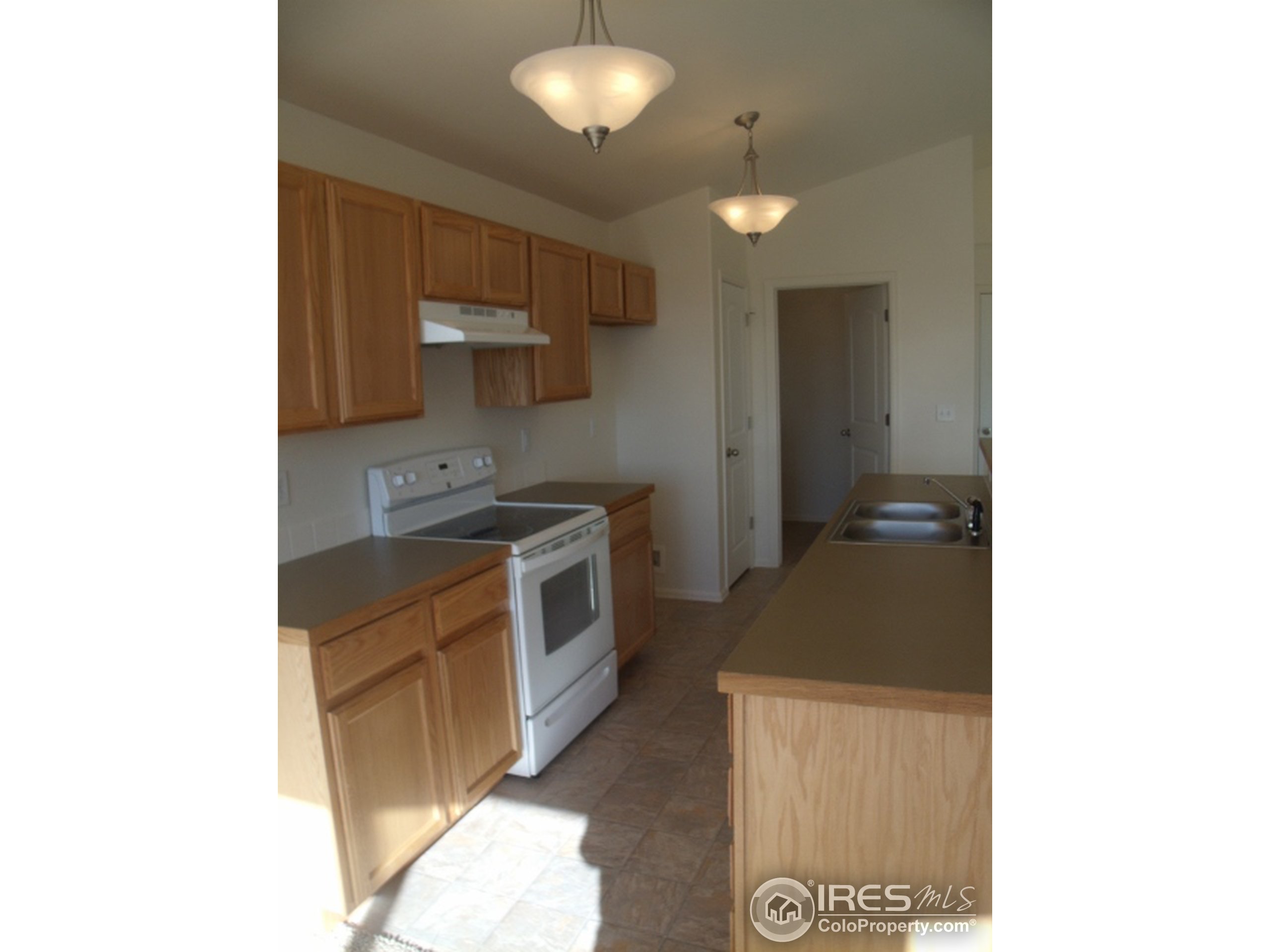 8611 15th St Road Greeley, CO 80634 - Photo 10 of 19 Gallery Image 10