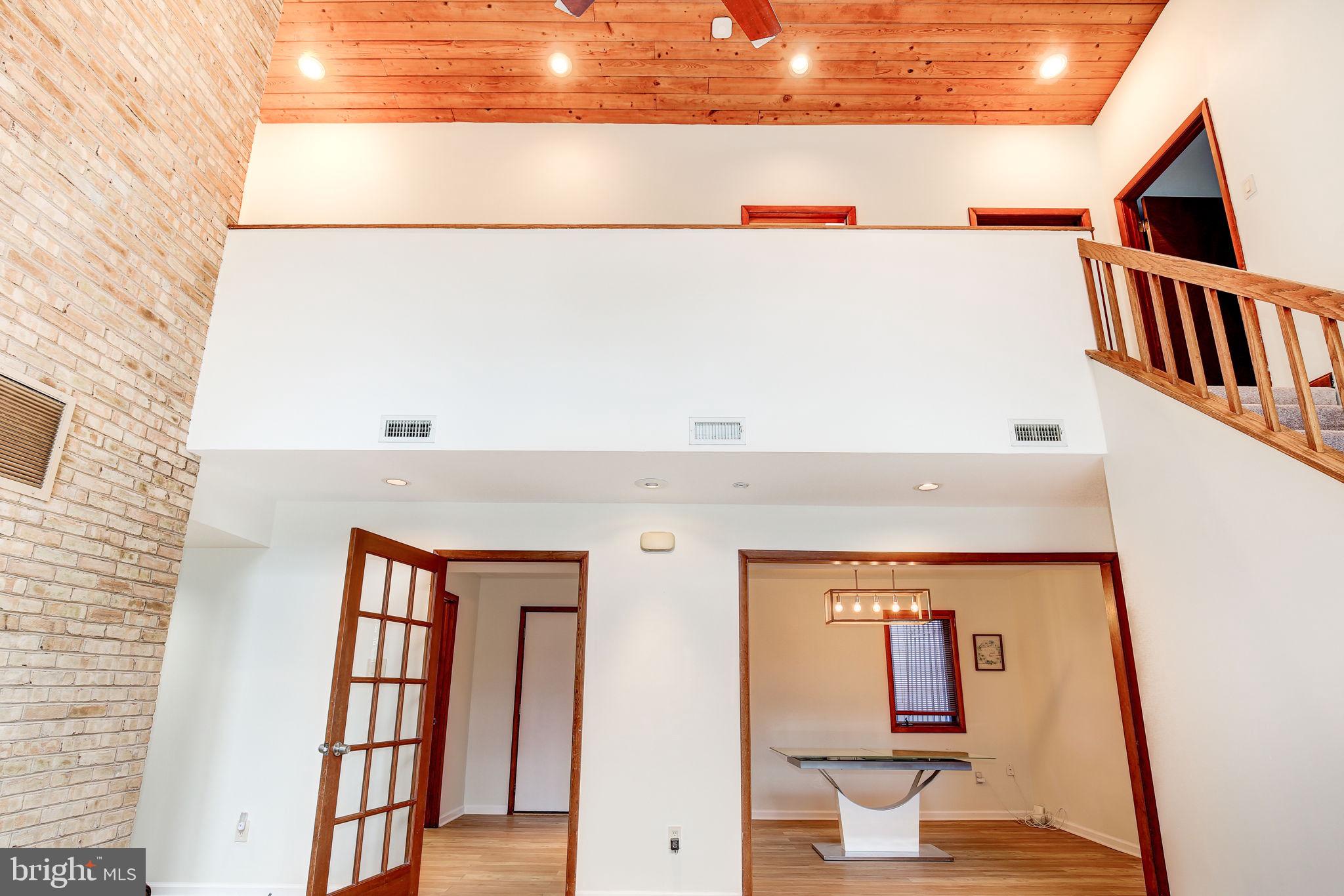 20811 Goshen Road Gaithersburg, MD 20882 - Photo 14 of 85 Gallery Image 14
