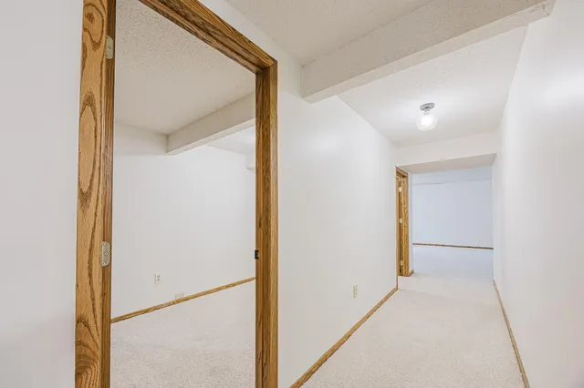 $415,000 | 15171 Elm Drive, Detroit Lakes, MN 56501