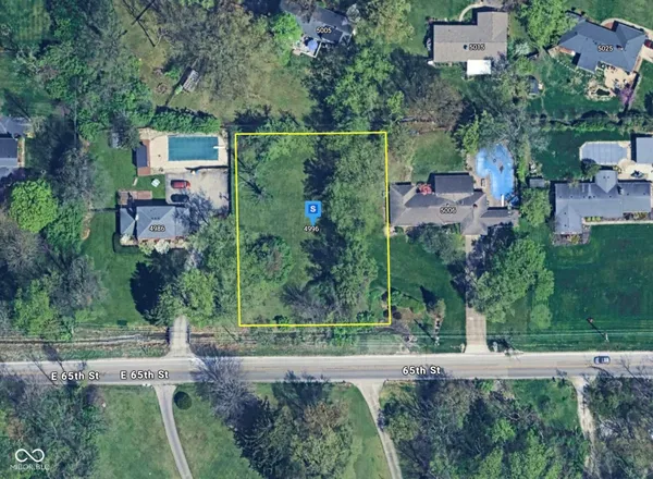 $62,999 | 4996 East 65th Street, Indianapolis, IN 46220