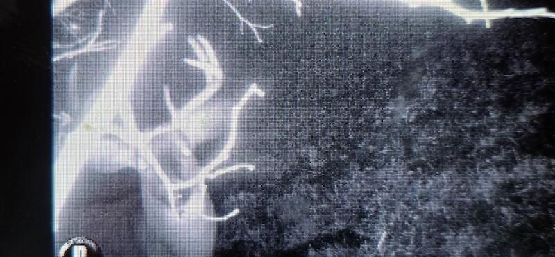 78.5-acres Alabaster Road Tawas City, MI 48763 - Photo 82 of 91 5279612928228139673